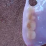 Aspen Dental - Partial