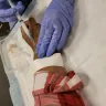 Mercy Medical Center - Cortisone shot/wrists treatment