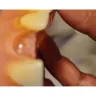Aspen Dental - Denture repair