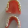 Aspen Dental - Dentures