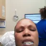 Aspen Dental - extractions & dentures