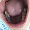 Aspen Dental - quality of work