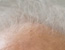 Consumers Lose on Hair Loss Company