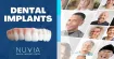 Nuvia Dental Implant Center