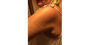 Royal Caribbean Cruises - Fleas in cabin/compensation for a ruined week of cruise/vouchers without permission