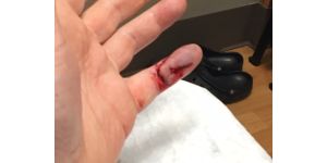 HomeGoods - Damaged Product