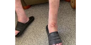 NordicTrack - Elliptical E7.0 weld failure