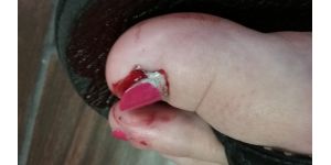 Old Navy - injury while shopping in the store