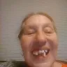 Aspen Dental - work that was done - Photo 12
