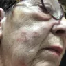 Super 8 - bed bugs and procedure to move us. - Photo 2