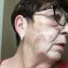 Super 8 - bed bugs and procedure to move us. - Photo 3