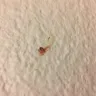 Motel 6 - health hazard - Photo 2
