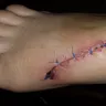 Black & Decker - accident dû à l'ouverture de la boîte du robot culinaire acheté le 30 juin 2018 (lame du robot a tombé sur mon pied) - Photo 2