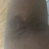 LabCorp - phlebotomist - Photo 5