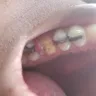 Coast Dental Services - service/product - unprofessional employees and bad service for crown - Photo 1
