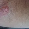 La Quinta Inns & Suites - bed bites, horrible manager and gm - Photo 1