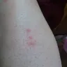 La Quinta Inns & Suites - bed bites, horrible manager and gm - Photo 3