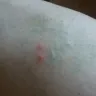 La Quinta Inns & Suites - bed bites, horrible manager and gm - Photo 4