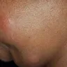 Motel 6 - Bed bugs - Photo 2