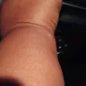 Motel 6 - Bed bugs - Photo 4