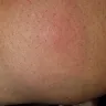 Motel 6 - Bed bugs - Photo 8