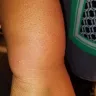 Motel 6 - Bed bugs - Photo 9