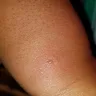 Motel 6 - Bed bugs - Photo 10