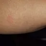 Motel 6 - Bed bugs - Photo 12