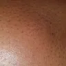 Motel 6 - Bed bugs - Photo 13