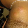 Motel 6 - Bed bugs - Photo 17