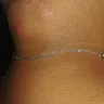 Motel 6 - Bed bugs - Photo 18