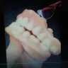 Affordable Dentures & Implants / Affordable Care - dentures and patient care - Photo 1
