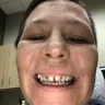 Aspen Dental - negligent/substandard 'care' - Photo 1