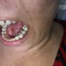 Aspen Dental - negligent/substandard 'care' - Photo 2
