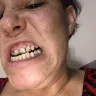 Aspen Dental - negligent/substandard 'care' - Photo 3