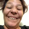 Aspen Dental - negligent/substandard 'care' - Photo 7