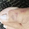 Dollar Tree - no first aid kit available for in-store injury - Photo 1