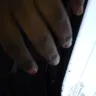 KIA Motors - accidental repair - Photo 1