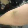 Quest Diagnostics - bloodwork being handled incorrectly - Photo 2