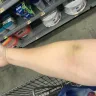 Quest Diagnostics - bloodwork being handled incorrectly - Photo 3