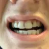 Aspen Dental - malpractice