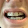 Aspen Dental - malpractice - Photo 1