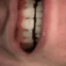 Aspen Dental - malpractice