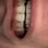Aspen Dental - malpractice - Photo 2