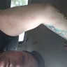 Americas Best Value Inn - Bedbugs - Photo 2