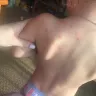 Great Wolf Lodge - bed bugs and horrible customer service - Photo 1