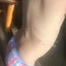 Great Wolf Lodge - bed bugs and horrible customer service - Photo 10