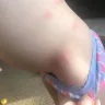 Great Wolf Lodge - bed bugs and horrible customer service - Photo 13