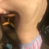 Great Wolf Lodge - bed bugs and horrible customer service - Photo 14