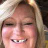 Aspen Dental - dentures/teeth extractions/ & treated unfairly - Photo 3